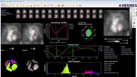 hermes studie|Hermes cardiology.